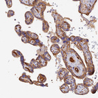 Anti-MROH1 Antibody