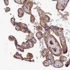 Immunohistochemical staining of human placenta shows strong cytoplasmic positivity in trophoblastic cells.