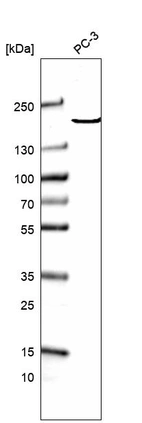 Western blot analysis in human cell line PC-3.