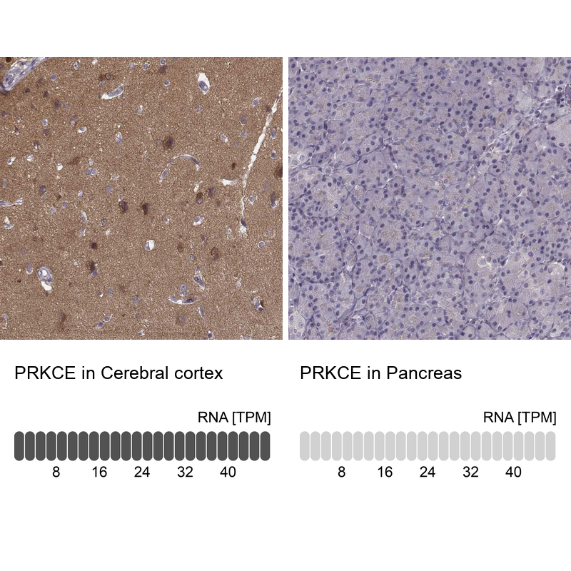 Anti-PRKCE Antibody