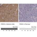 Anti-PRKCE Antibody