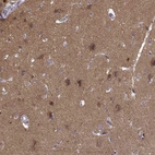 Immunohistochemical staining of human cerebral cortex shows strong cytoplasmic positivity in neurons.