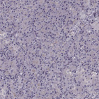 Immunohistochemical staining of human pancreas shows no positivity in exocrine glandular cells as expected.