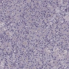 Immunohistochemical staining of human pancreas shows no positivity in exocrine glandular cells as expected.