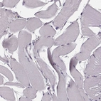 Immunohistochemical staining of human skeletal muscle shows no positivity in myocytes as expected.