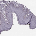 Immunohistochemical staining of human skin shows no positivity in squamous epithelial cells as expected.