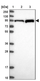 Lane 1: Marker [kDa] 250, 130, 95, 72, 55, 36, 28, 17, 10_br/_Lane 2: Human cell line RT-4_br/_Lane 3: Human cell line U-251 MG