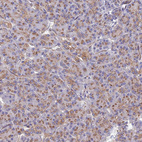 Anti-ADGRF3 Antibody