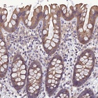 Anti-GALR2 Antibody