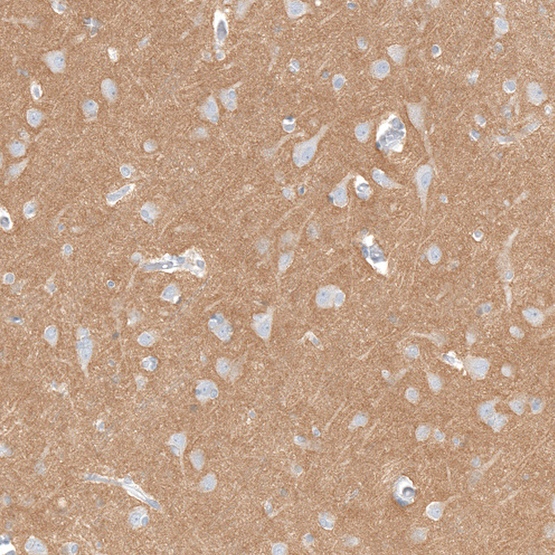 Anti-IGSF21 Antibody