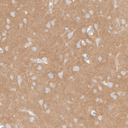 Anti-IGSF21 Antibody