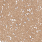 Anti-IGSF21 Antibody