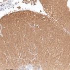 Anti-IGSF21 Antibody