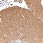Immunohistochemical staining of human cerebellum shows moderate positivity in neuropil.