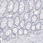 Immunohistochemical staining of human colon shows no positivity in glandular cells as expected.