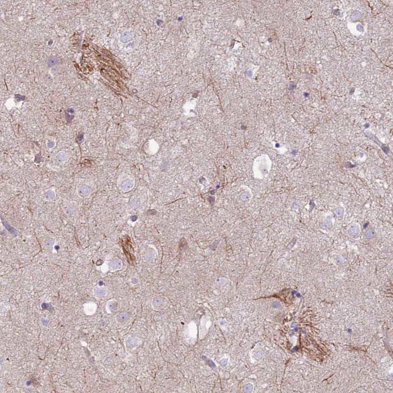 Anti-KCNAB1 Antibody