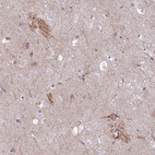 Anti-KCNAB1 Antibody