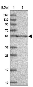 Lane 1: Marker [kDa] 250, 130, 95, 72, 55, 36, 28, 17, 10_br/_Lane 2: Human cell line RT-4