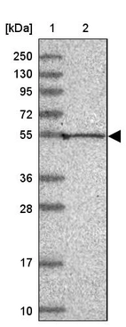 Lane 1: Marker [kDa] 250, 130, 95, 72, 55, 36, 28, 17, 10_br/_Lane 2: Human cell line RT-4
