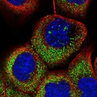 Immunofluorescent staining of human cell line A-431 shows localization to nucleoli & cytosol.