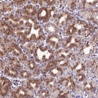 Anti-GOLPH3 Antibody