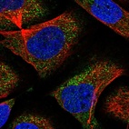 Immunofluorescent staining of human cell line U-2 OS shows localization to cytosol.
