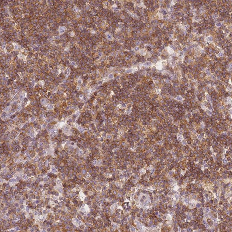 Anti-JAKMIP1 Antibody