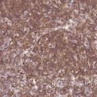 Anti-JAKMIP1 Antibody