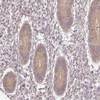 Anti-ADH5 Antibody