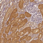 Immunohistochemical staining of human kidney shows strong cytoplasmic positivity in cells in tubules.