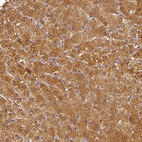 Anti-ADH5 Antibody