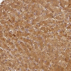 Immunohistochemical staining of human liver shows strong cytoplasmic positivity in hepatocytes.