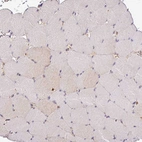 Immunohistochemical staining of human skeletal muscle shows very weak positivity in myocytes.