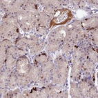 Anti-ACSM6 Antibody