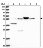 Lane 1: Marker [kDa] 250, 130, 95, 72, 55, 36, 28, 17, 10_br/_Lane 2: Human cell line RT-4_br/_Lane 3: Human cell line U-251MG sp_br/_Lane 4: Human plasma (IgG/HSA depleted)_br/_Lane 5: Human liver tissue_br/_Lane 6: Human tonsil tissue