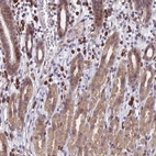 Anti-PPP1R26 Antibody