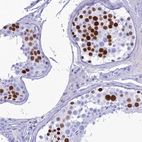 Immunohistochemical staining of human testis shows strong nuclear positivity in cells in seminiferous ducts.