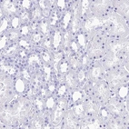 Immunohistochemical staining of human kidney shows no positivity in cells in tubules as expected.