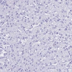 Immunohistochemical staining of human liver shows no positivity in hepatocytes as expected.