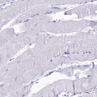 Immunohistochemical staining of human skeletal muscle shows no positivity in myocytes as expected.