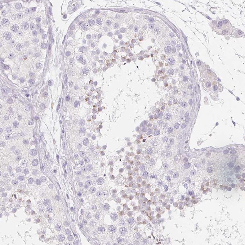 Anti-SPACA5B Antibody