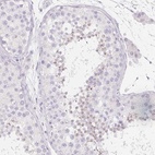 Anti-SPACA5B Antibody