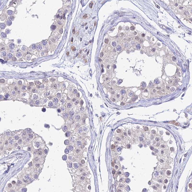 Anti-C6orf163 Antibody