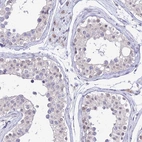 Anti-C6orf163 Antibody