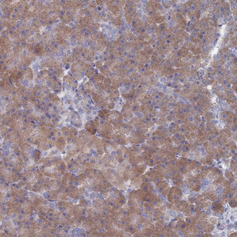 Anti-TMEM128 Antibody