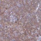 Anti-TMEM128 Antibody
