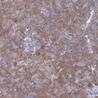 Anti-TMEM128 Antibody