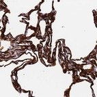 Anti-CAV2 Antibody