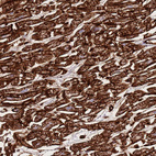 Immunohistochemical staining of human heart muscle shows strong cytoplasmic and membrnaous positivity in cardiomyocytes.
