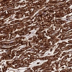 Immunohistochemical staining of human heart muscle shows strong cytoplasmic and membrnaous positivity in cardiomyocytes.